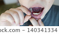 A 10-year-old boy shows a fresh empty socket in his lower jaw after losing a baby tooth. He holds the shed milk tooth in his hand, highlighting natural childhood development and dental growth. 140341334
