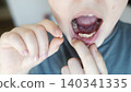 A 10-year-old boy shows a fresh empty socket in his lower jaw after losing a baby tooth. He holds the shed milk tooth in his hand, highlighting natural childhood development and dental growth. A 10-year-old boy shows a fresh empty socket in his lower jaw after losing a baby tooth. He holds the shed milk tooth in his hand, highlighting natural childhood development and dental growth. 140341335