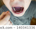 A 10-year-old boy shows a fresh empty socket in his lower jaw after losing a baby tooth. He holds the shed milk tooth in his hand, highlighting natural childhood development and dental growth. A 10-year-old boy shows a fresh empty socket in his lower jaw after losing a baby tooth. He holds the shed milk tooth in his hand, highlighting natural childhood development and dental growth. 140341336