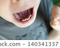 A 10-year-old boy shows a fresh empty socket in his lower jaw after losing a baby tooth. He holds the shed milk tooth in his hand, highlighting natural childhood development and dental growth. A 10-year-old boy shows a fresh empty socket in his lower jaw after losing a baby tooth. He holds the shed milk tooth in his hand, highlighting natural childhood development and dental growth. 140341337