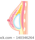 Hybrid breast augmentation; Types of breast augmentation surgery; Cosmetic surgery; Breasts 140346264