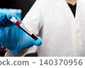 Scientist Holding Tick-borne Encephalitis Blood Sample Tube 140370956