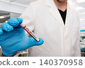 Scientist Holding Lyme Disease Positive Blood Test Tube 140370958