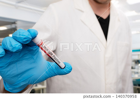 Scientist Holding Lyme Disease Positive Blood Test Tube Scientist Holding Lyme Disease Positive Blood Test Tube 140370958
