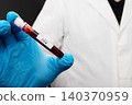 Gloved Hand Holding HIV Positive Blood Test Tube 140370959