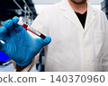 Gloved Hand Holding HIV Positive Blood Test Tube 140370960