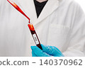 Laboratory Worker Pipetting Blood into HIV Test Tube 140370962