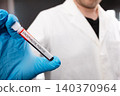 Scientist Holding Tick-borne Encephalitis Blood Sample Tube 140370964