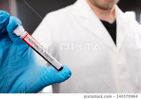 Scientist Holding Tick-borne Encephalitis Blood Sample Tube Scientist Holding Tick-borne Encephalitis Blood Sample Tube 140370964
