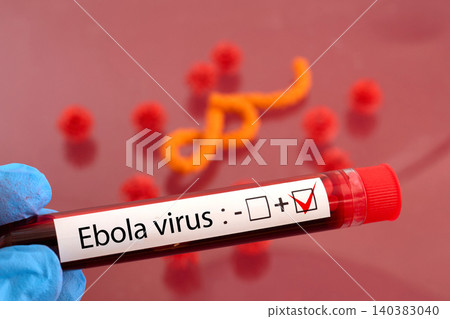 Hand holding ebola virus positive blood test Hand holding ebola virus positive blood test 140383040