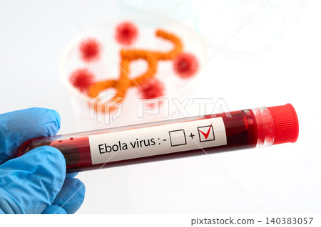 Hand holding ebola virus positive blood test 140383057