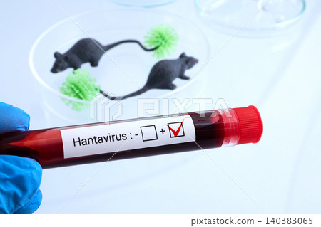 Hand holding hantavirus blood test tube with positive result Hand holding hantavirus blood test tube with positive result 140383065