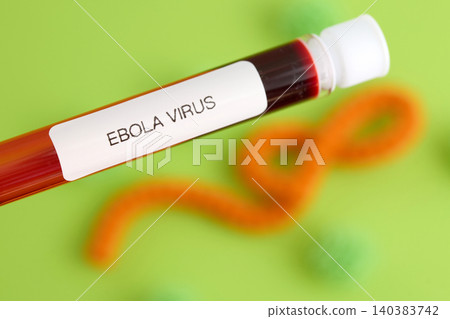 Ebola virus blood sample test tube showing infection Ebola virus blood sample test tube showing infection 140383742