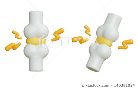 3D Rendered Bone Joint with Pain and Inflammation Effects for Arthritis Concept Design 3D Rendered Bone Joint with Pain and Inflammation Effects for Arthritis Concept Design 140391084