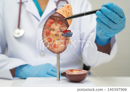 Chronic kidney disease, doctor with model for treatment urinary system, urology, Estimated glomerular filtration rate eGFR. Chronic kidney disease, doctor with model for treatment urinary system, urology, Estimated glomerular filtration rate eGFR. 140397906