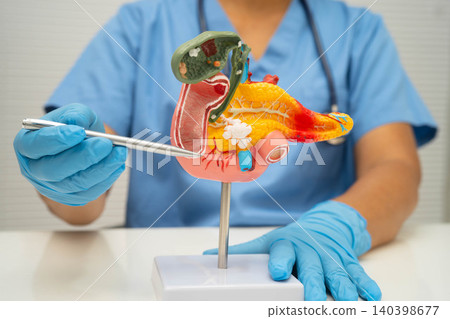 Pancreatitis, pancreatic cancer, Asian doctor with pancreas, gallbladder and bile duct human anatomy model at hospital. 140398677