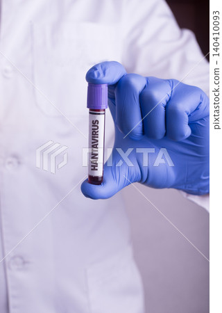 Close-up of medical worker in protective gloves holding blood test tube labeled hantavirus. Healthcare, laboratory diagnostics, and infectious disease testing concept. 140410093