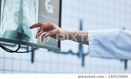 Doctor hand pointing at a spine x-ray on screen for medical diagnosis Doctor hand pointing at a spine x-ray on screen for medical diagnosis 140410864