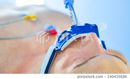 Patient receiving oxygen therapy through a laryngeal mask airway in a hospital setting Patient receiving oxygen therapy through a laryngeal mask airway in a hospital setting 140410886