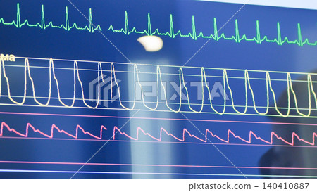 Heartbeat monitoring on a medical display showing vital signs and ECG waveform Heartbeat monitoring on a medical display showing vital signs and ECG waveform 140410887