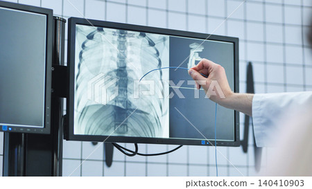 Surgeon guiding catheter on screen with x-ray for advanced medical procedure Surgeon guiding catheter on screen with x-ray for advanced medical procedure 140410903