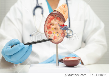 Chronic kidney disease, Asian woman with model for treatment urinary system, urology, Estimated glomerular filtration rate eGFR. Chronic kidney disease, Asian woman with model for treatment urinary system, urology, Estimated glomerular filtration rate eGFR. 140414893