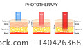 Phototherapy. Light penetration and skin effects comparison for NIR near infrared wavelength, 140426368