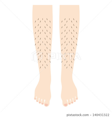 Illustration of legs with a lot of leg hair 140431322