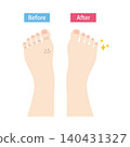 Before and after photos of feet with noticeable toe hair. 140431327