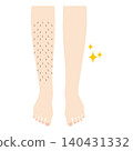 Legs before and after hair removal 140431332
