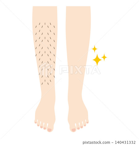 Legs before and after hair removal Legs before and after hair removal 140431332