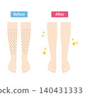 Legs before and after hair removal 140431333