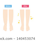 Before and after photos of swollen legs 140453074