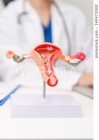 Doctor with Uterus and Ovaries anatomy model. Ovarian and Cervical cancer, Cervix disorder, Endometriosis, Hysterectomy, Uterine fibroids, Reproductive system, Pregnancy and health concept Doctor with Uterus and Ovaries anatomy model. Ovarian and Cervical cancer, Cervix disorder, Endometriosis, Hysterectomy, Uterine fibroids, Reproductive system, Pregnancy and health concept 140473008