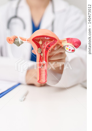 Doctor with Uterus and Ovaries anatomy model. Ovarian and Cervical cancer, Cervix disorder, Endometriosis, Hysterectomy, Uterine fibroids, Reproductive system, Pregnancy and health concept Doctor with Uterus and Ovaries anatomy model. Ovarian and Cervical cancer, Cervix disorder, Endometriosis, Hysterectomy, Uterine fibroids, Reproductive system, Pregnancy and health concept 140473012