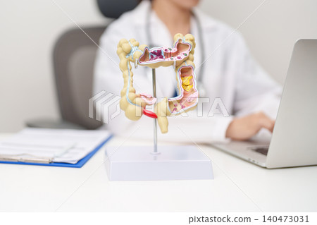 Doctor with human Colon anatomy model. Colonic disease, Large Intestine, Colorectal cancer, Ulcerative colitis, Diverticulitis, Irritable bowel syndrome, Digestive system and Healthcare concept Doctor with human Colon anatomy model. Colonic disease, Large Intestine, Colorectal cancer, Ulcerative colitis, Diverticulitis, Irritable bowel syndrome, Digestive system and Healthcare concept 140473031