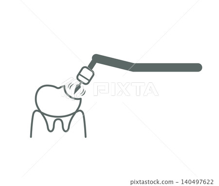 An illustration of a tooth being drilled during cavity treatment. An illustration of a tooth being drilled during cavity treatment. 140497622