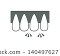 Illustration of gaps between teeth 140497627