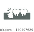 An illustration of an impacted wisdom tooth growing sideways inside the gums. 140497629