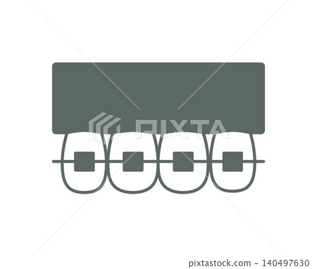 Illustration of braces using wires 140497630