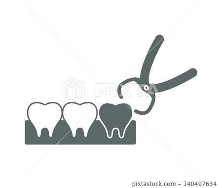 An illustration depicting the extraction of a single tooth, such as one that has become problematic due to decay, using forceps. An illustration depicting the extraction of a single tooth, such as one that has become problematic due to decay, using forceps. 140497634