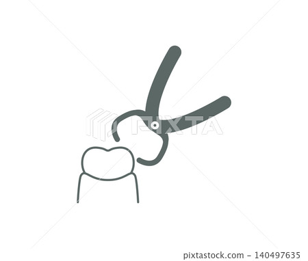 An illustrative image of a tooth extraction procedure using forceps. An illustrative image of a tooth extraction procedure using forceps. 140497635