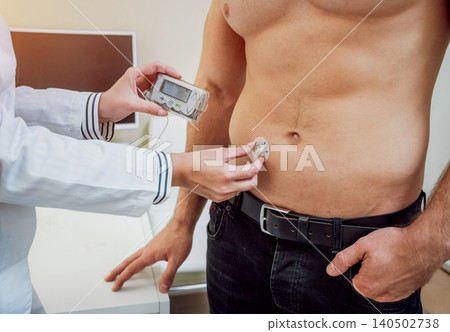 Doctor with an insulin pump connected in patient abdomen and holding the insulin pump at his hands. 140502738