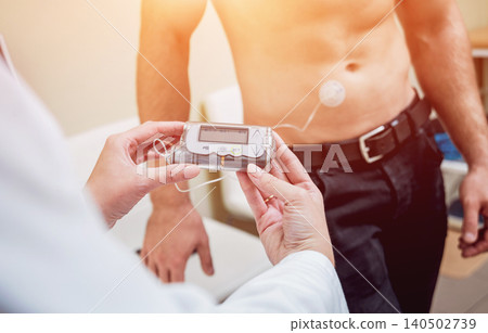 Doctor with an insulin pump connected in patient abdomen and holding the insulin pump at his hands. 140502739