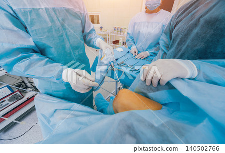 Arthroscope surgery. Orthopedic surgeons in teamwork in the operating room with modern arthroscopic tools. Knee surgery. Arthroscope surgery. Orthopedic surgeons in teamwork in the operating room with modern arthroscopic tools. Knee surgery. 140502766