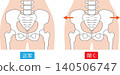 Normal pelvis vs. open pelvis 140506747