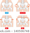 Normal pelvis vs. distorted pelvic type 140506748