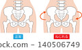 Normal pelvis vs. twisted pelvis 140506749
