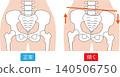Normal pelvis vs. tilted pelvis 140506750