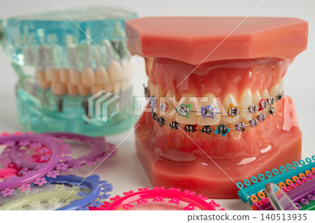 Orthodontic ligatures rings and ties, elastic rubber bands on orthodontic braces, model for dentist studying about dentistry. Orthodontic ligatures rings and ties, elastic rubber bands on orthodontic braces, model for dentist studying about dentistry. 140513935